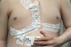 通院日記 1回目『通院とホルター心電図』